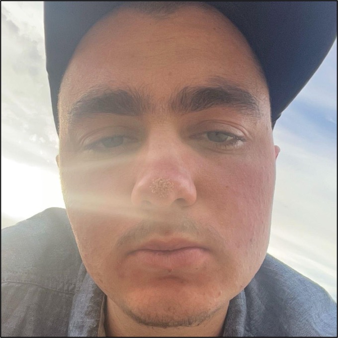 A white person with facial hair stares softly into the camera. Ze wears a black baseball cap and a light blue shirt. Behind him is a light blue sky, white clouds, and sun rays.
